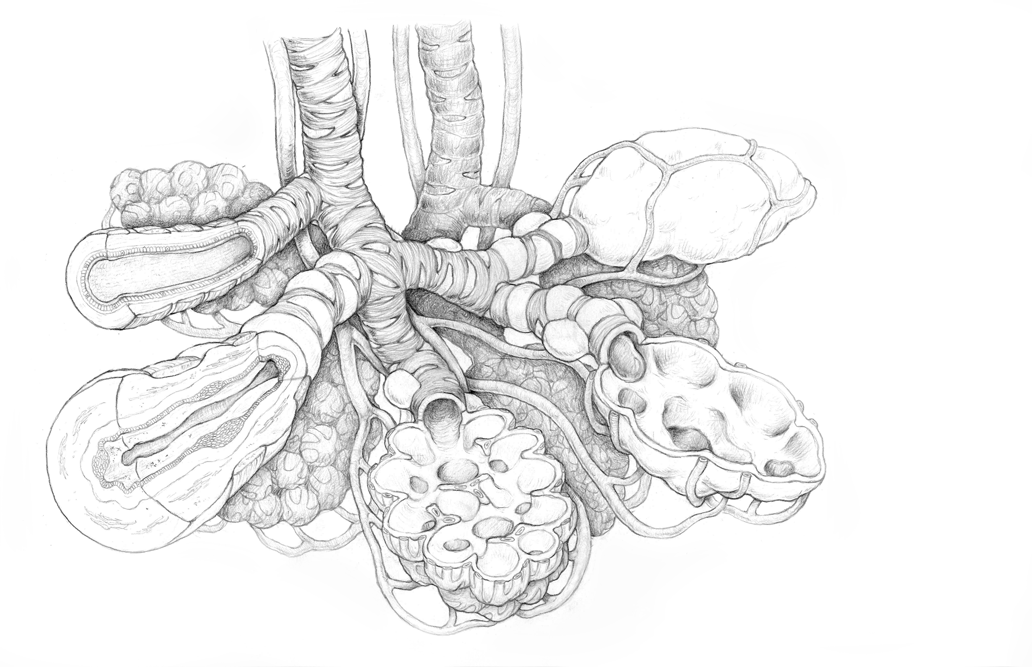 final COPD sketch